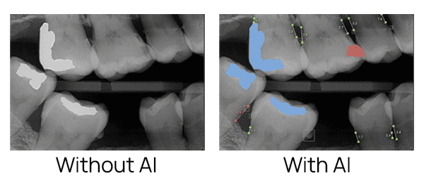 Comparison of traditional dental X-ray review and AI-assisted diagnostics technology.